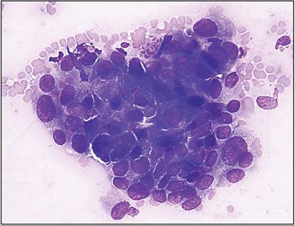 fig18.49.jpg