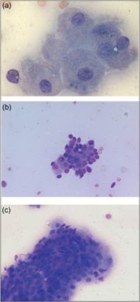 fig4.51a-c.jpg