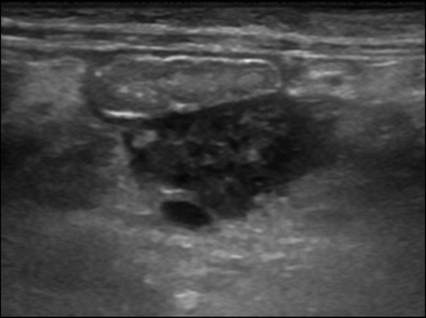 fig8.42.jpg