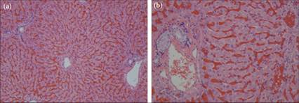 fig9.2aB.jpg