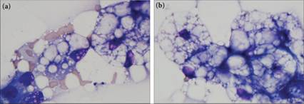 fig9.11A.jpg
