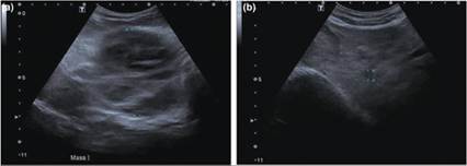fig9.60A.jpg