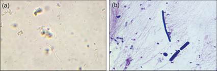 fig10.58A.jpg