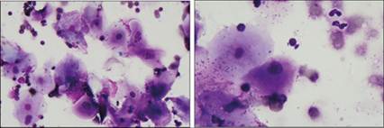 fig11.4-5.jpg