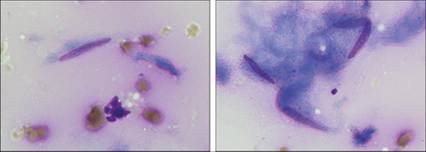 fig11.15-16.jpg
