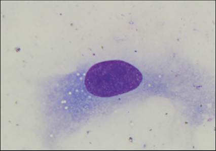 fig11.17.jpg