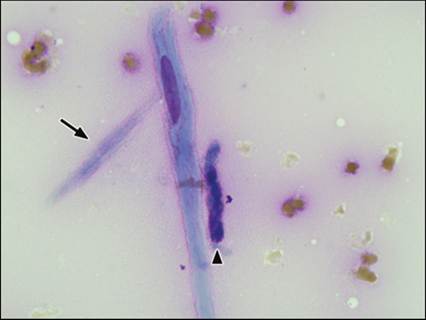 fig11.23.jpg