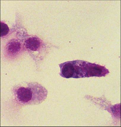 fig13.30.jpg