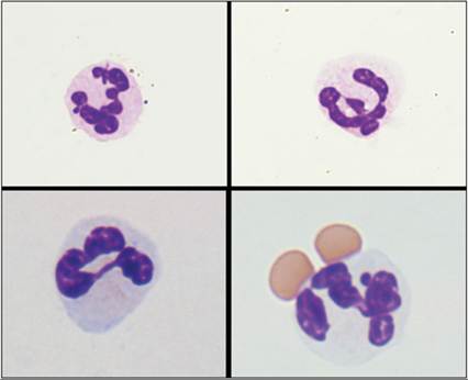fig14.13.jpg