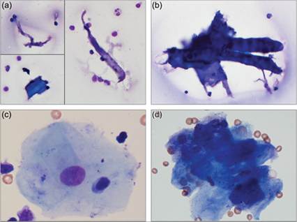 fig14.17A.jpg