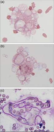 fig14.23A-C.jpg