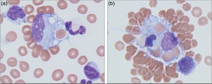 fig14.24A.jpg