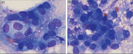 fig14.29A.jpg