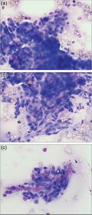 fig14.39A-C.jpg