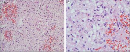 fig14.42A.jpg