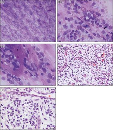 fig14.43A-E.jpg