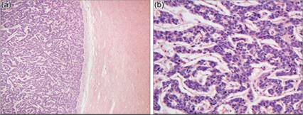 fig14.49A.jpg