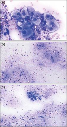 fig14.50A-C.jpg