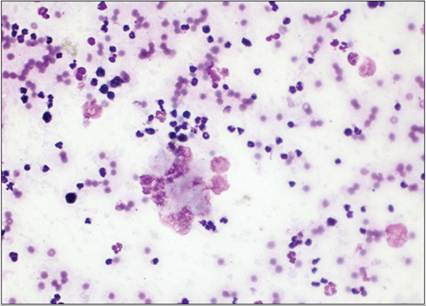 fig15.25.jpg