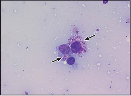 fig17.13.jpg