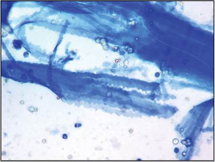 fig17.22.jpg